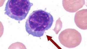 骨髓嗜多染紅細(xì)胞測試